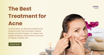 Acne Treatments